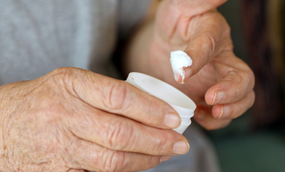 incontinence associated dermatitis (iad) - prevention and management